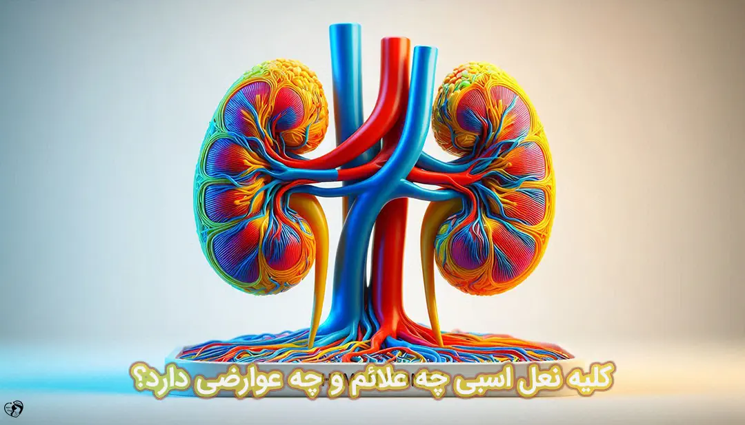 کلیه نعل اسبی کلیه نعل اسبی