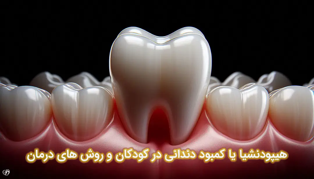 هیپودنشیا هیپودنشیا