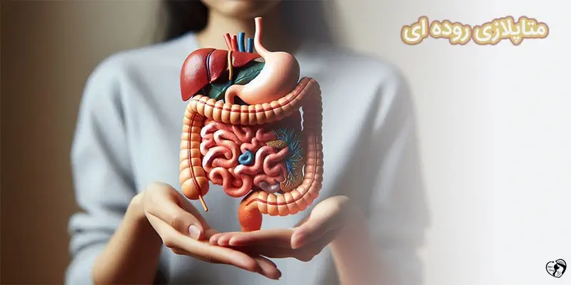 Intestinal Metaplasia متاپلازی روده ای