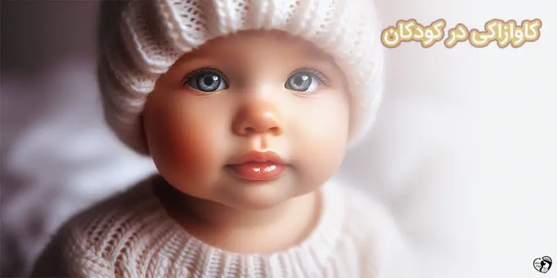 Kawasaki disease کاوازاکی در کودکان