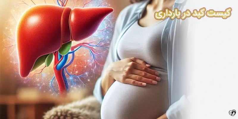 Liver cyst during pregnancy کیست کبد در بارداری