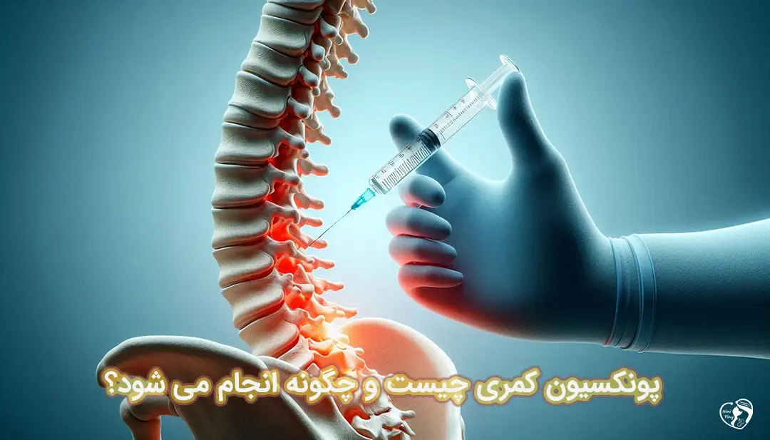 پونکسیون کمری