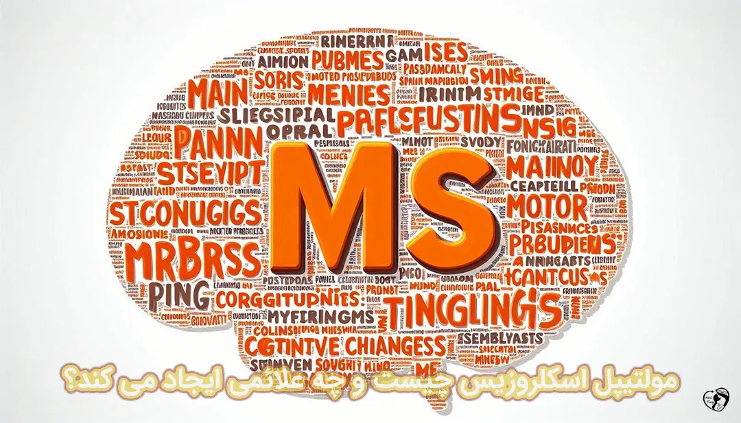 مولتیپل اسکلروزیس