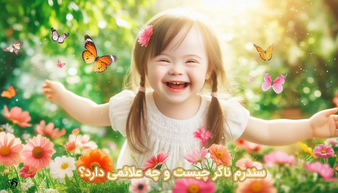 سندرم ناگر سندرم ناگر