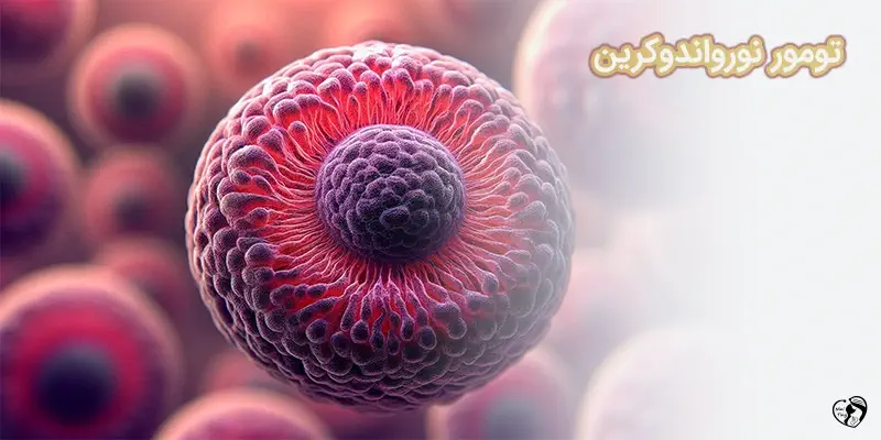 تومور نورواندوکرین