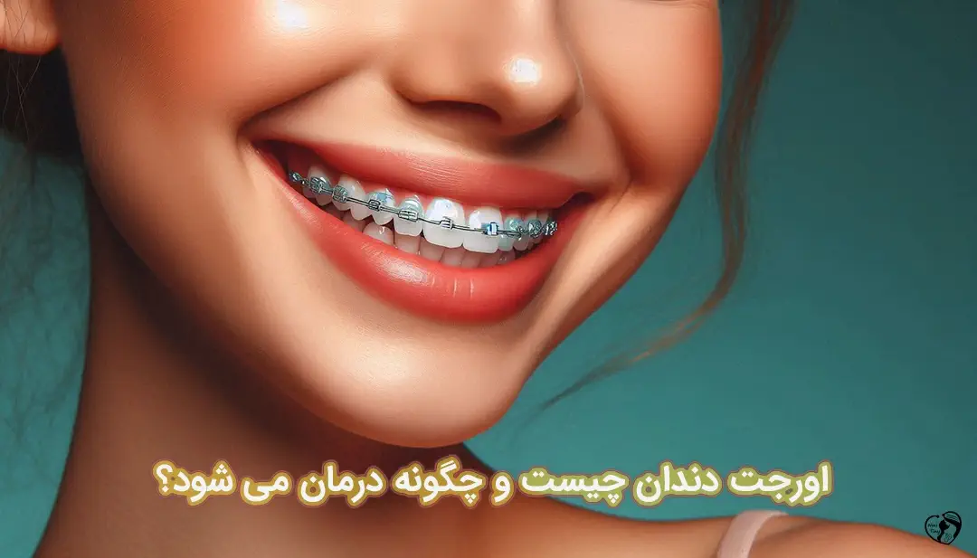 اورجت دندان