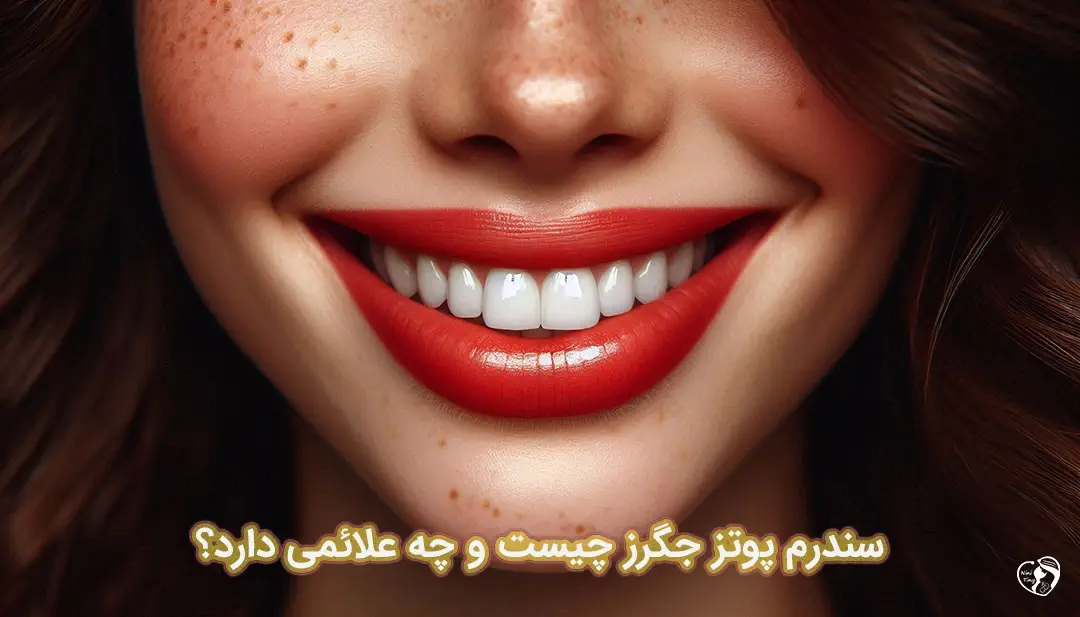 سندرم پوتز جگرز سندرم پوتز جگرز