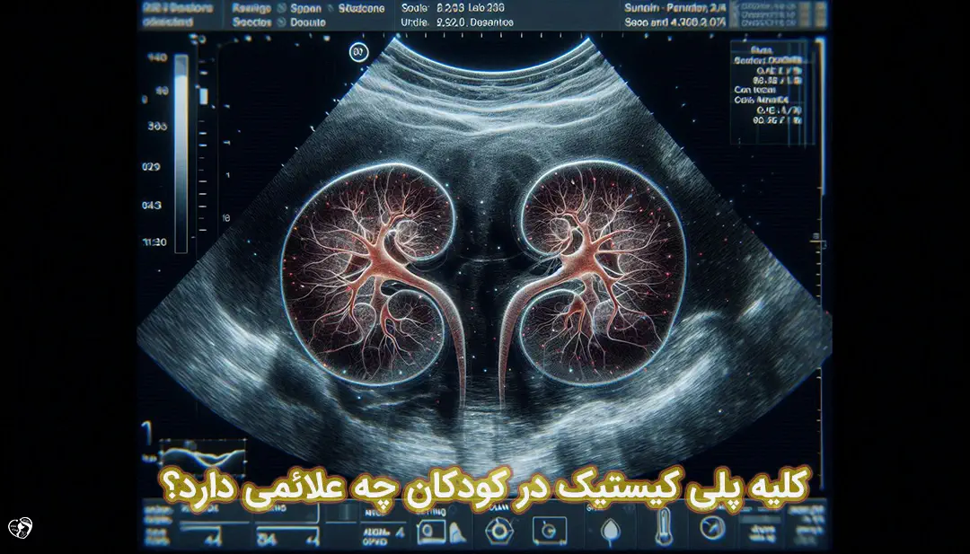 کلیه پلی کیستیک در کودکان کلیه پلی کیستیک در کودکان