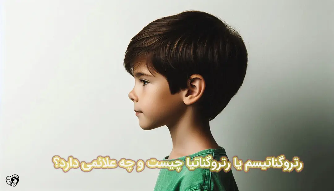 رتروگناتیسم رتروگناتیسم