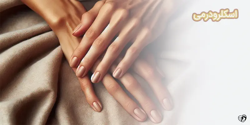 Scleroderma اسکلرودرمی