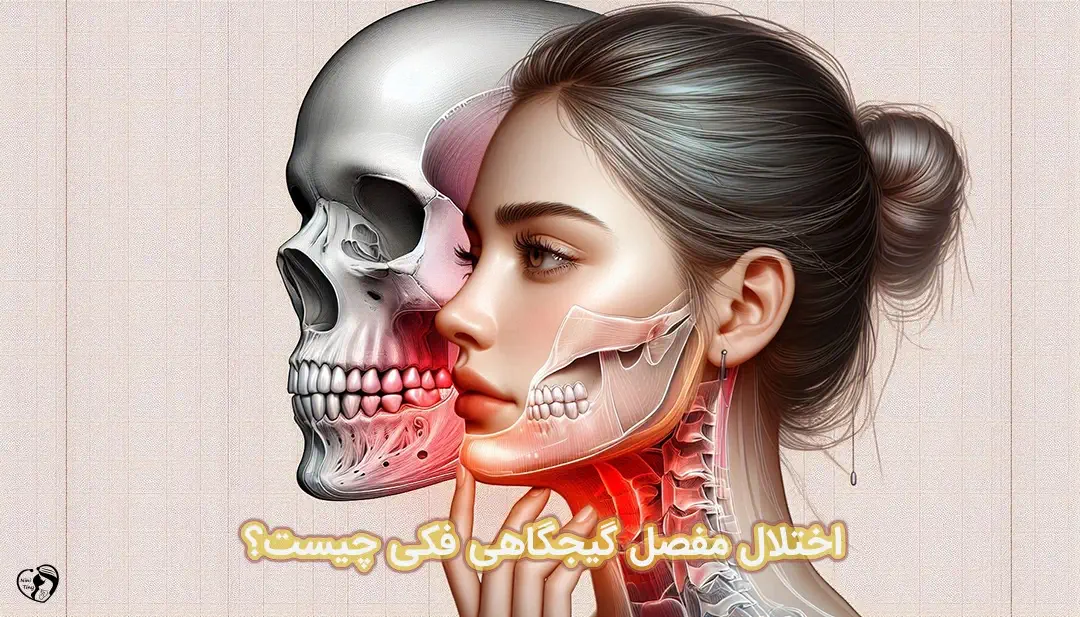 اختلال مفصل گیجگاهی فکی اختلال مفصل گیجگاهی فکی