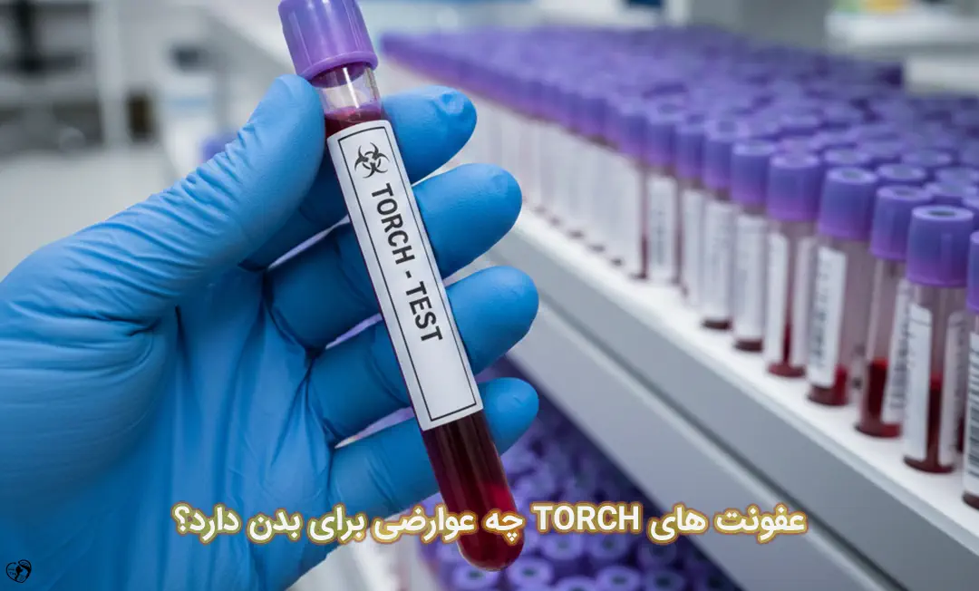 عفونت های TORCH 