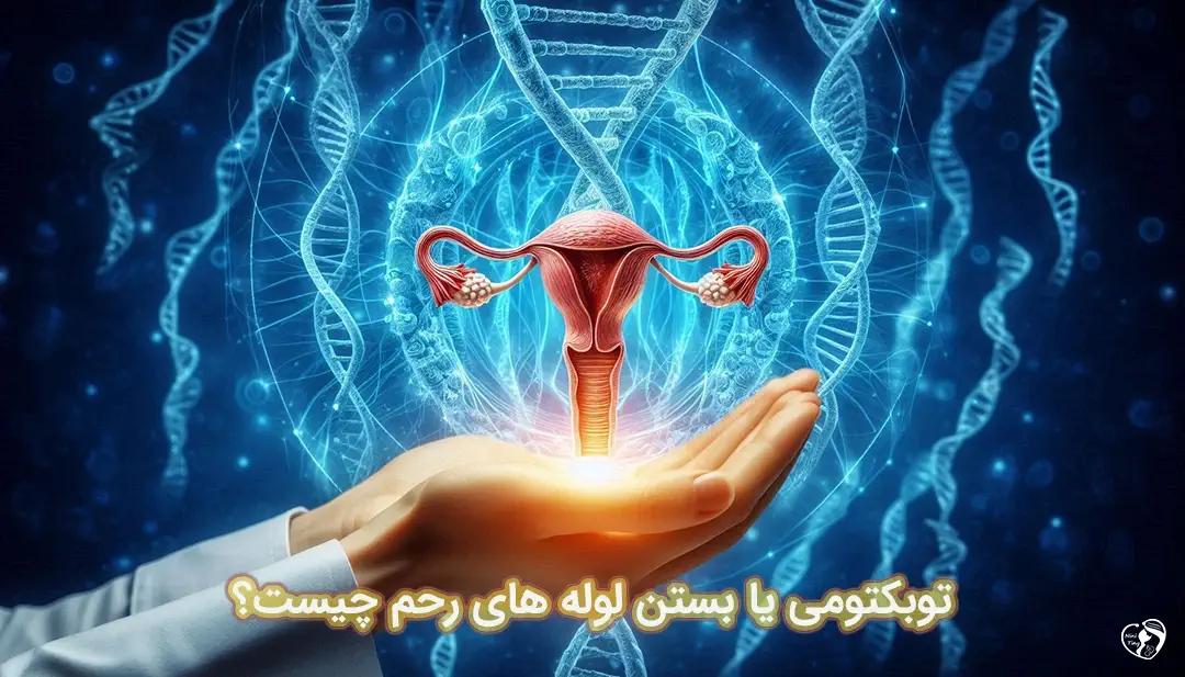 بستن لوله های رحم بستن لوله های رحم