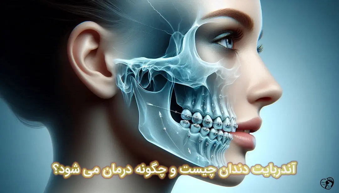 آندربایت دندان